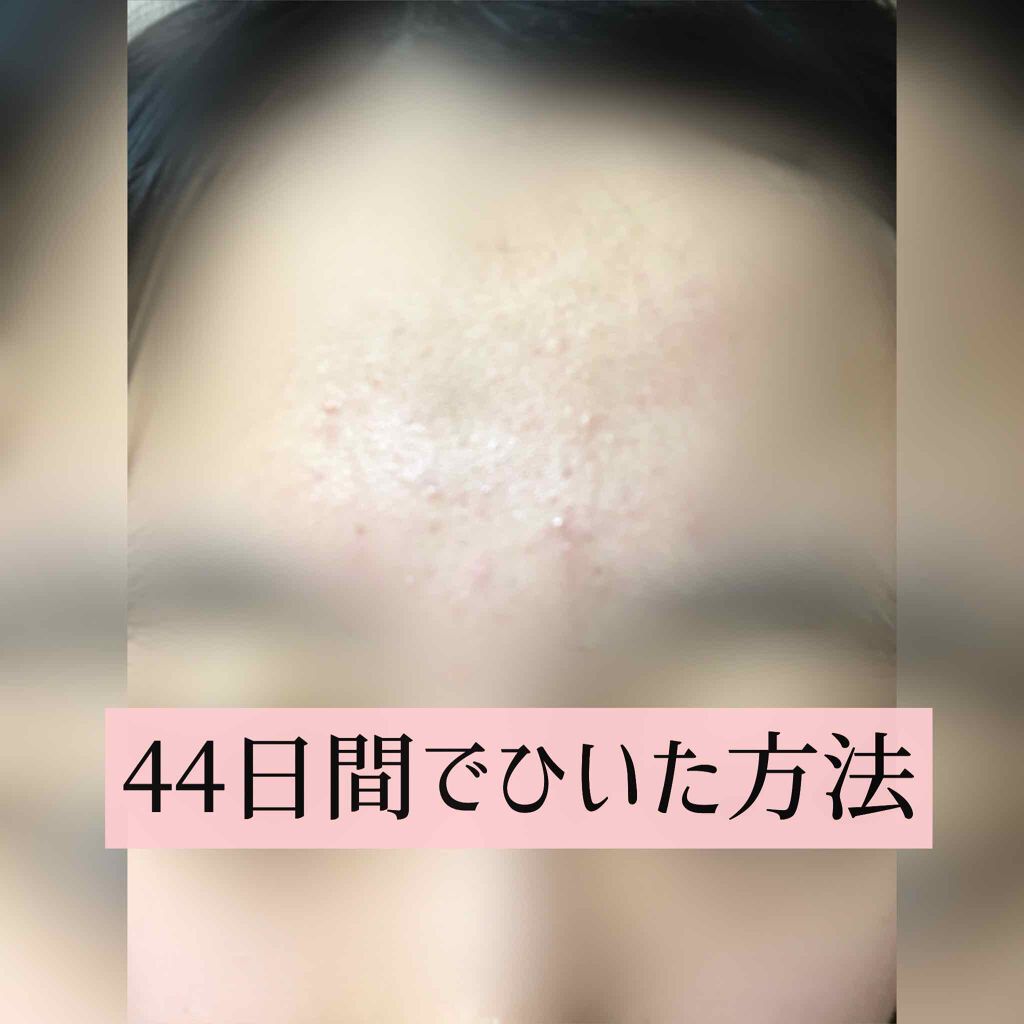 化粧水・敏感肌用・高保湿タイプ/無印良品/化粧水を使ったクチコミ(3枚目)