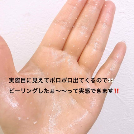 ナチュラルクッションピーリング/アカラン/ピーリングを使ったクチコミ(3枚目)