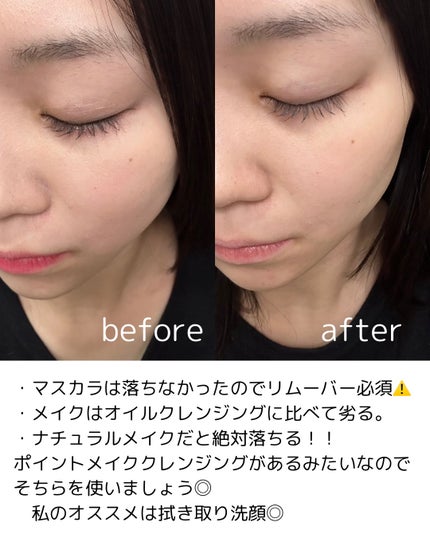 サンシビオ エイチツーオー D/ビオデルマ/クレンジングウォーターを使ったクチコミ(8枚目)