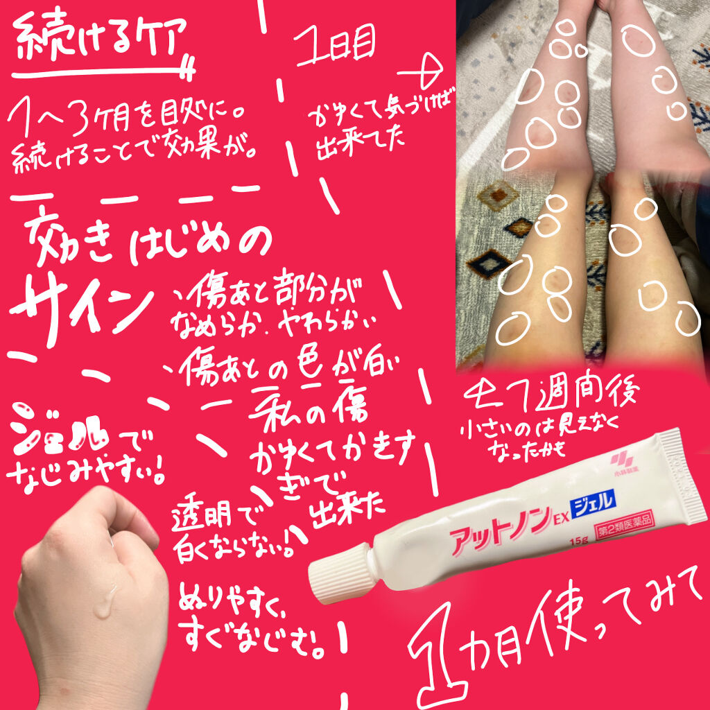 を使ったクチコミ（2枚目）