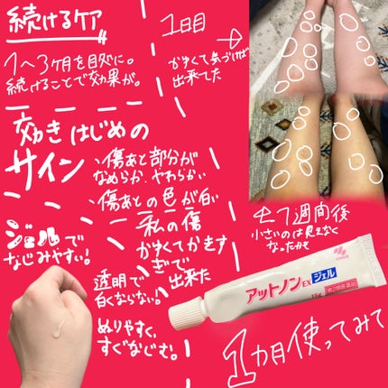 を使ったクチコミ(2枚目)