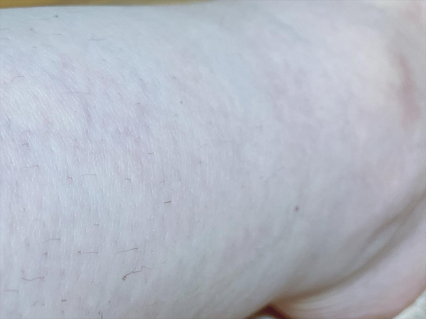 パイナップル豆乳除毛クリーム/鈴木ハーブ研究所/除毛クリームを使ったクチコミ(4枚目)