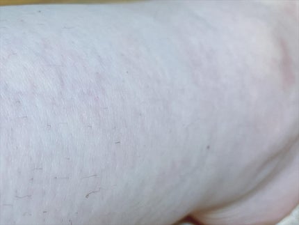 パイナップル豆乳除毛クリーム/鈴木ハーブ研究所/除毛クリームを使ったクチコミ(4枚目)