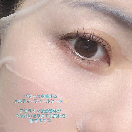 ルルルン ハイドラ AZ マスク/ルルルン/シートマスク・パックを使ったクチコミ(2枚目)