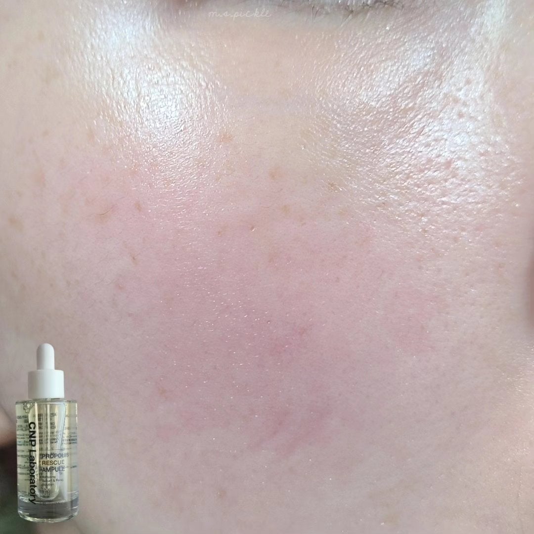 プロポリスレスキューアンプル 50ml/CNP Laboratory/美容液を使ったクチコミ(4枚目)