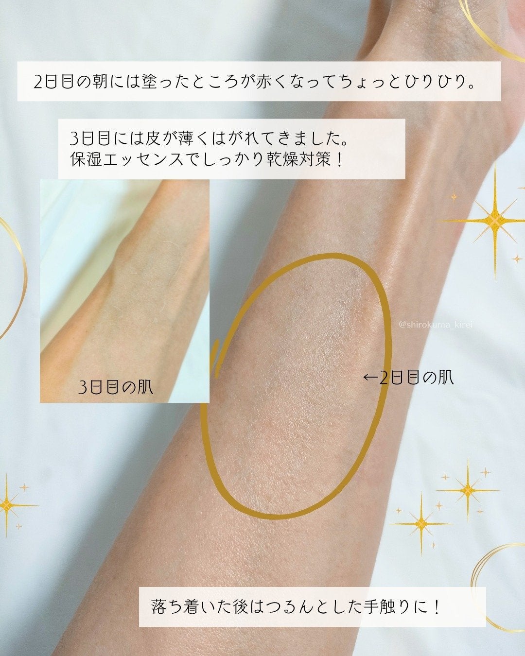 ダーマスキンピーリング/BQCELL/その他キットセットを使ったクチコミ(5枚目)