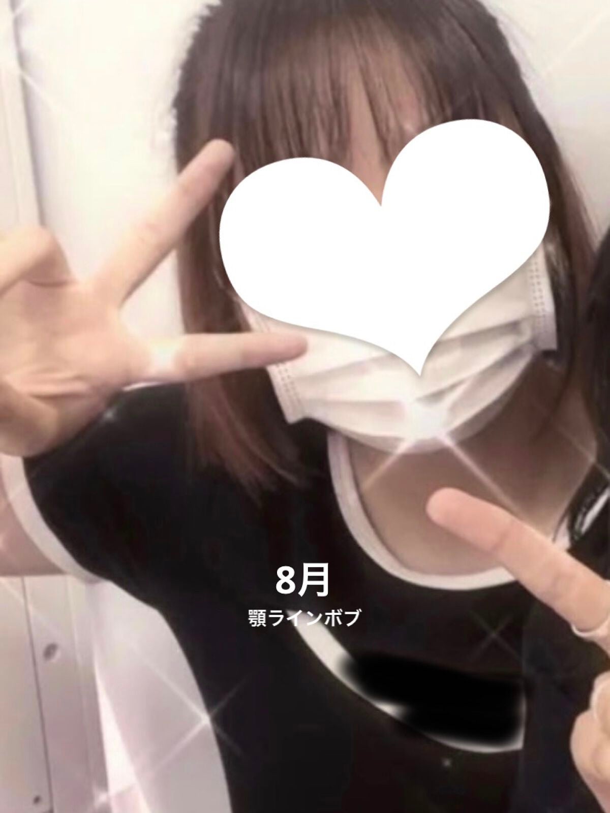 ヘアアクセルレーターEX フローラルアップルの香り/加美乃素本舗/頭皮ローションを使ったクチコミ(2枚目)