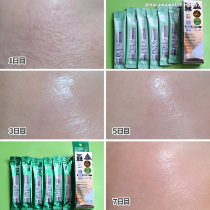 リードルS 100 2ステップマスク/VT/シートマスク・パックを使ったクチコミ(10枚目)