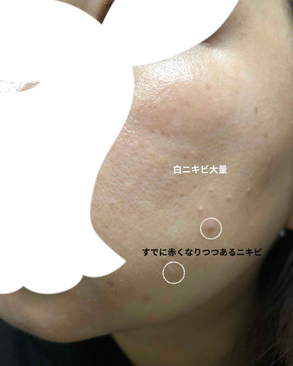 肌をうるおす保湿クリーム/肌をうるおす保湿スキンケア/フェイスクリームを使ったクチコミ(2枚目)