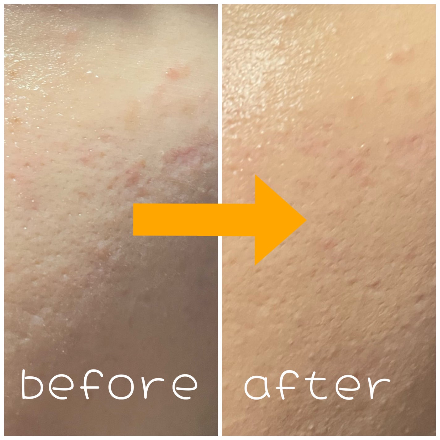 ロングラスティングチップコンシーラー/LUNA/リキッドコンシーラーを使ったクチコミ(2枚目)