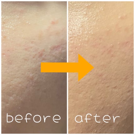 ロングラスティングチップコンシーラー/LUNA/リキッドコンシーラーを使ったクチコミ(2枚目)