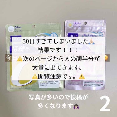 続きです🧸

少しビタミンを飲む量減らしたり元に戻したりしていたので、(なんで変えた)ちゃんとした結果になっていないと思います。すみません😥

毎日、クリームは塗っていたのでそのクリームの効果は思ってい