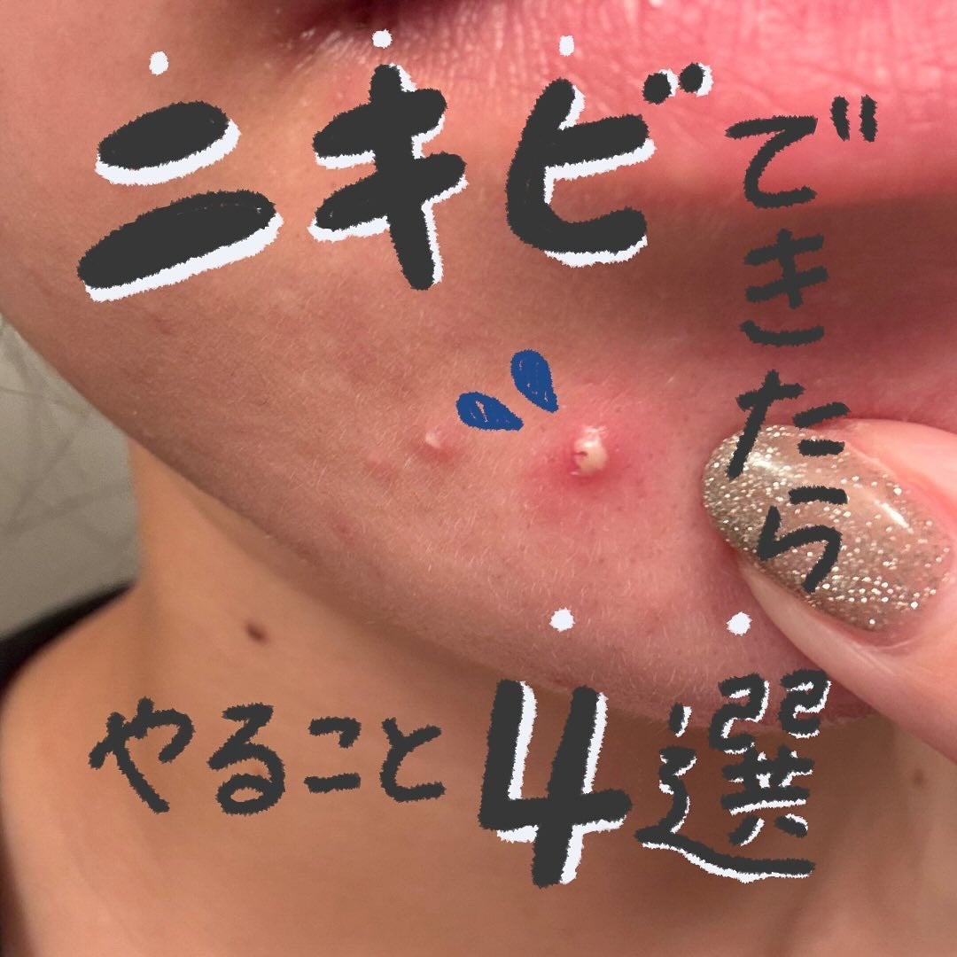 プロCICA クリアスポットパッチ/VT/その他スキンケアを使ったクチコミ(1枚目)