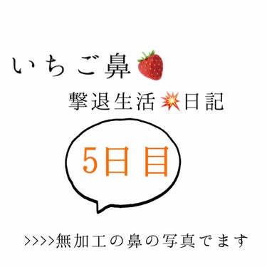 いちご鼻撃退日記5日目！

今日ポロポロ感は少なめでしたー
横が少し薄くなって気がする…

毎回写真の明るさ違くてすみません🙇


#いちご鼻 #毛穴ケア #撃退日記