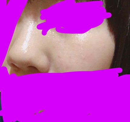 ワンステップオリジナルクリアパッド/COSRX/トナーパッドを使ったクチコミ(3枚目)