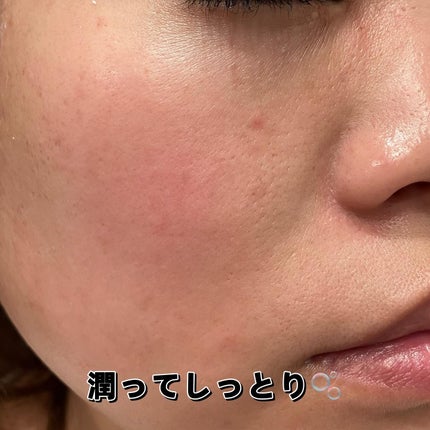 グリーントマトクリーム/FULLY/フェイスクリームを使ったクチコミ(5枚目)