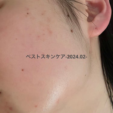 アスタリフト ジェリー アクアリスタ 20g/アスタリフト/美容液を使ったクチコミ（1枚目）