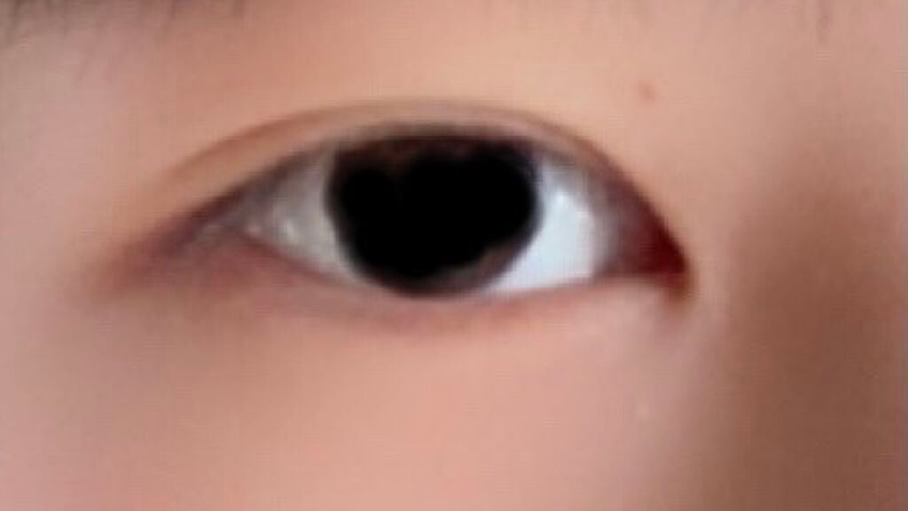 みゅう on LIPS 「私の1つ目の写真は奥二重ですか??2つ目は二重ですよね?..」(2枚目)