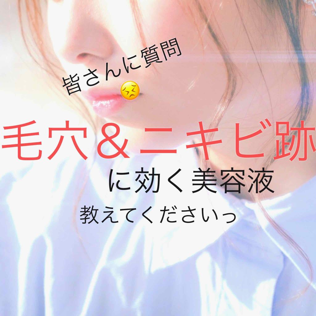 凜音.*・゚ on LIPS 「お久しぶりです、凜音です!先日やーっと定期考査が終わりまして、..」(1枚目)