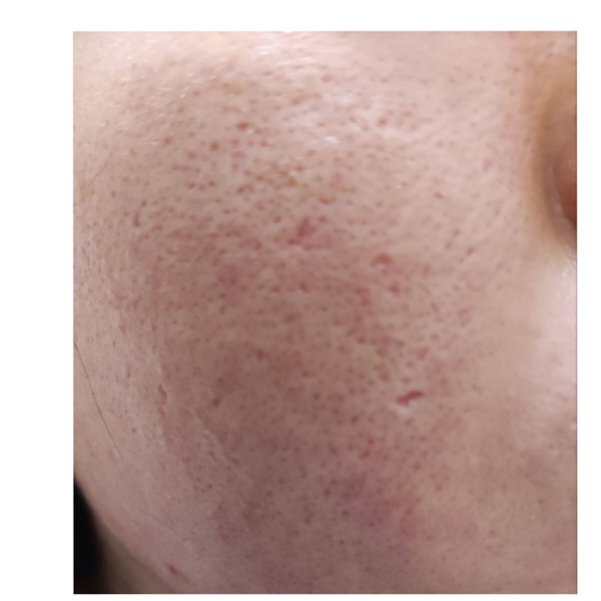 ハトムギ化粧水(ナチュリエ スキンコンディショナー R )/ナチュリエ/化粧水を使ったクチコミ（1枚目）