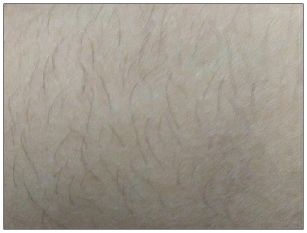 つるすべ除毛パッド/DAISO/ムダ毛ケアを使ったクチコミ（2枚目）