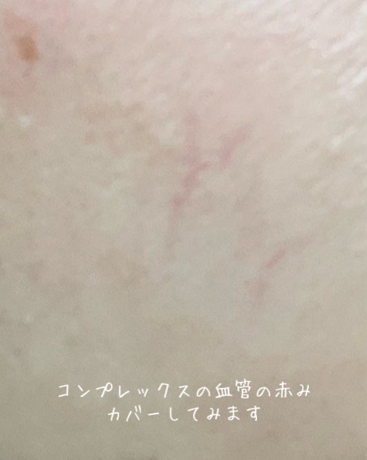 ダブルラスティング コンシーラーパレット/ETUDE/パレットコンシーラーを使ったクチコミ(4枚目)