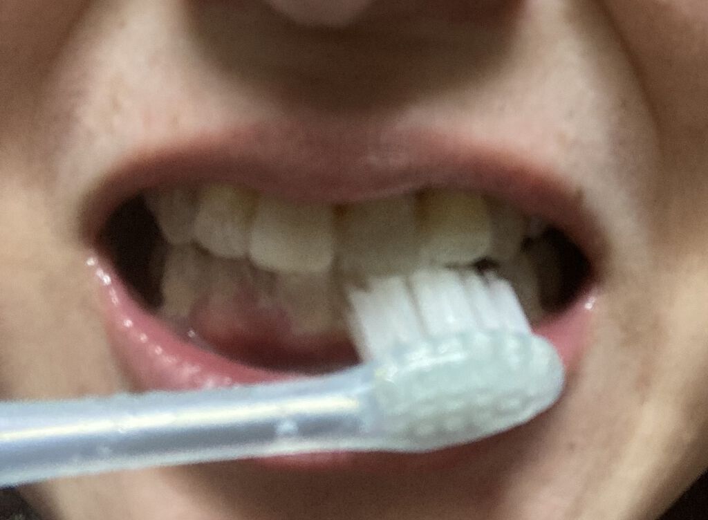 イオン歯ブラシ ionic(アイオニック) 極細薄型コンパクト 本体 ふつう　/アイオニック/歯ブラシを使ったクチコミ（3枚目）