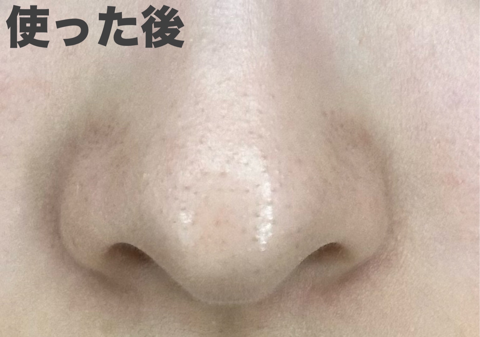 パーフェクトワンフォーカス スムースクレンジングバーム ディープブラック クロミ 限定デザイン（75g）/PERFECT ONE  FOCUS/クレンジングバームを使ったクチコミ（3枚目）