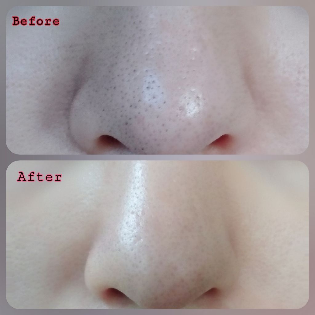 精製水（医薬品）/健栄製薬/その他を使ったクチコミ（2枚目）