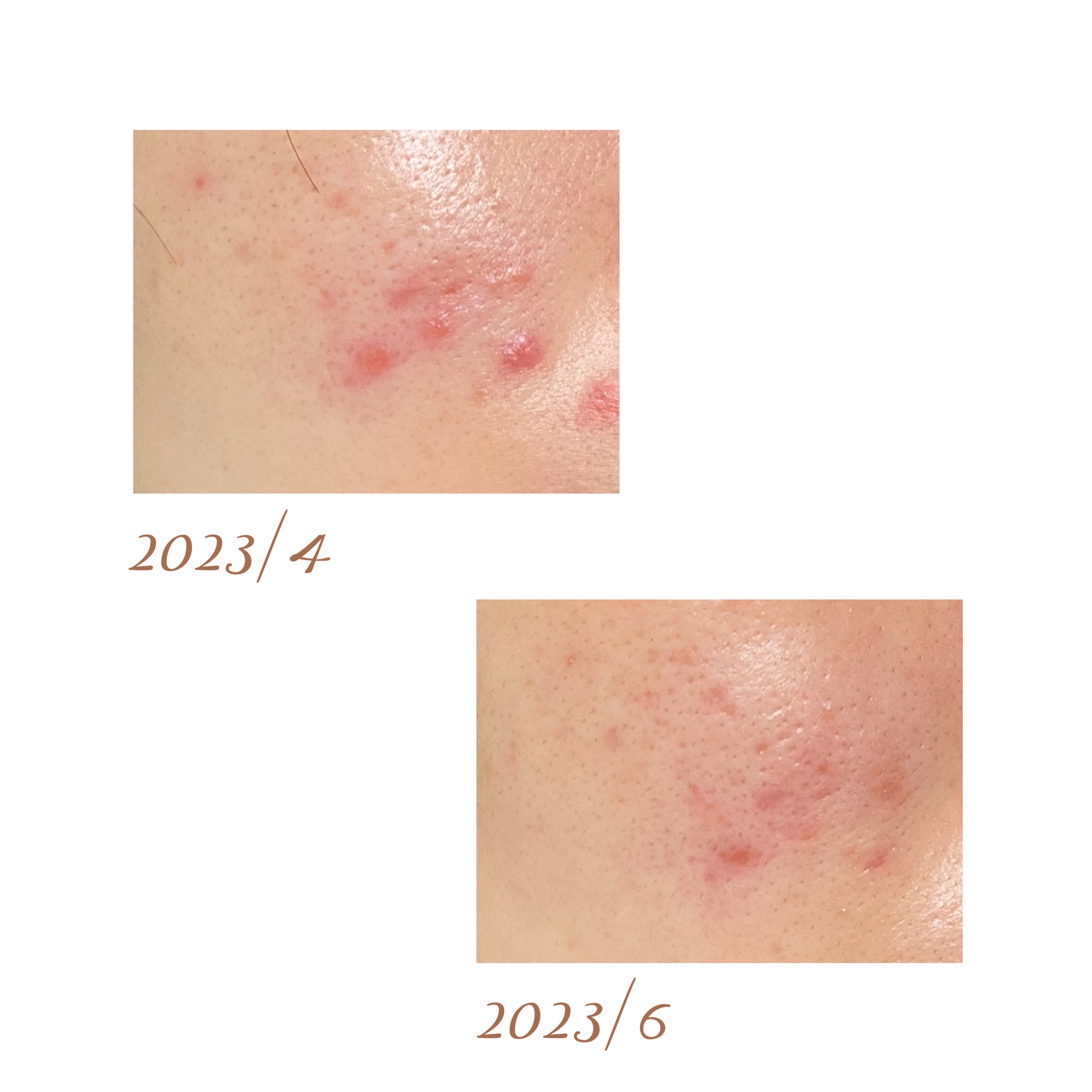 レチビタエッセンスマスク/ピュレア/シートマスク・パックを使ったクチコミ（3枚目）