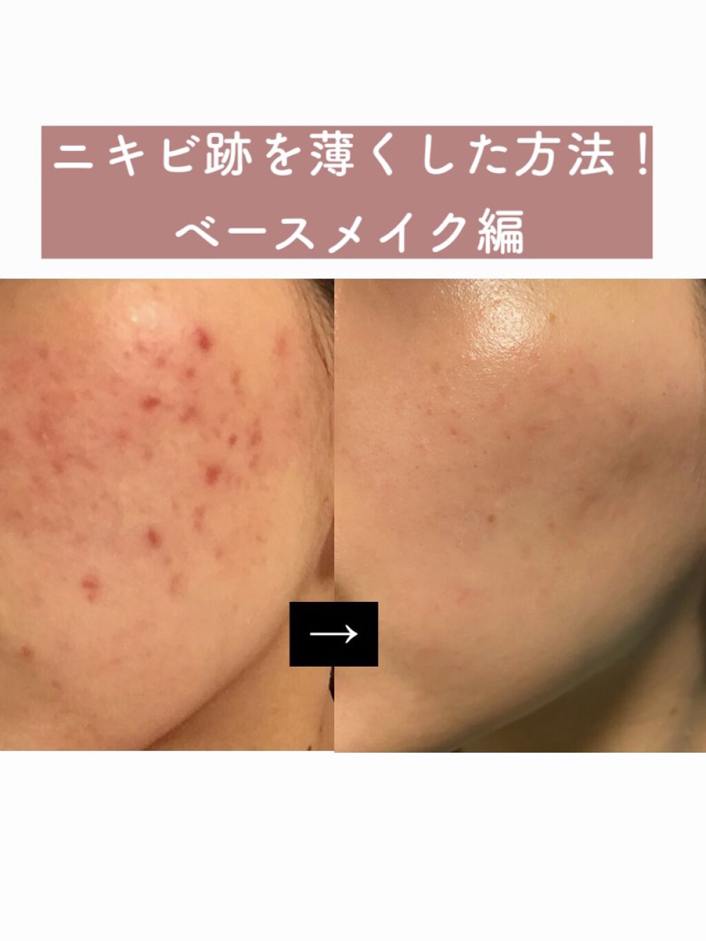 ミネラルシルクファンデーション（ケース・パフ付）/ヴァントルテ/パウダーファンデーションを使ったクチコミ（1枚目）