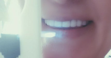 HITEETH ALL IN ONE MOUTH GEL SHINING LEDライト付き/R&/その他オーラルケアを使ったクチコミ(2枚目)