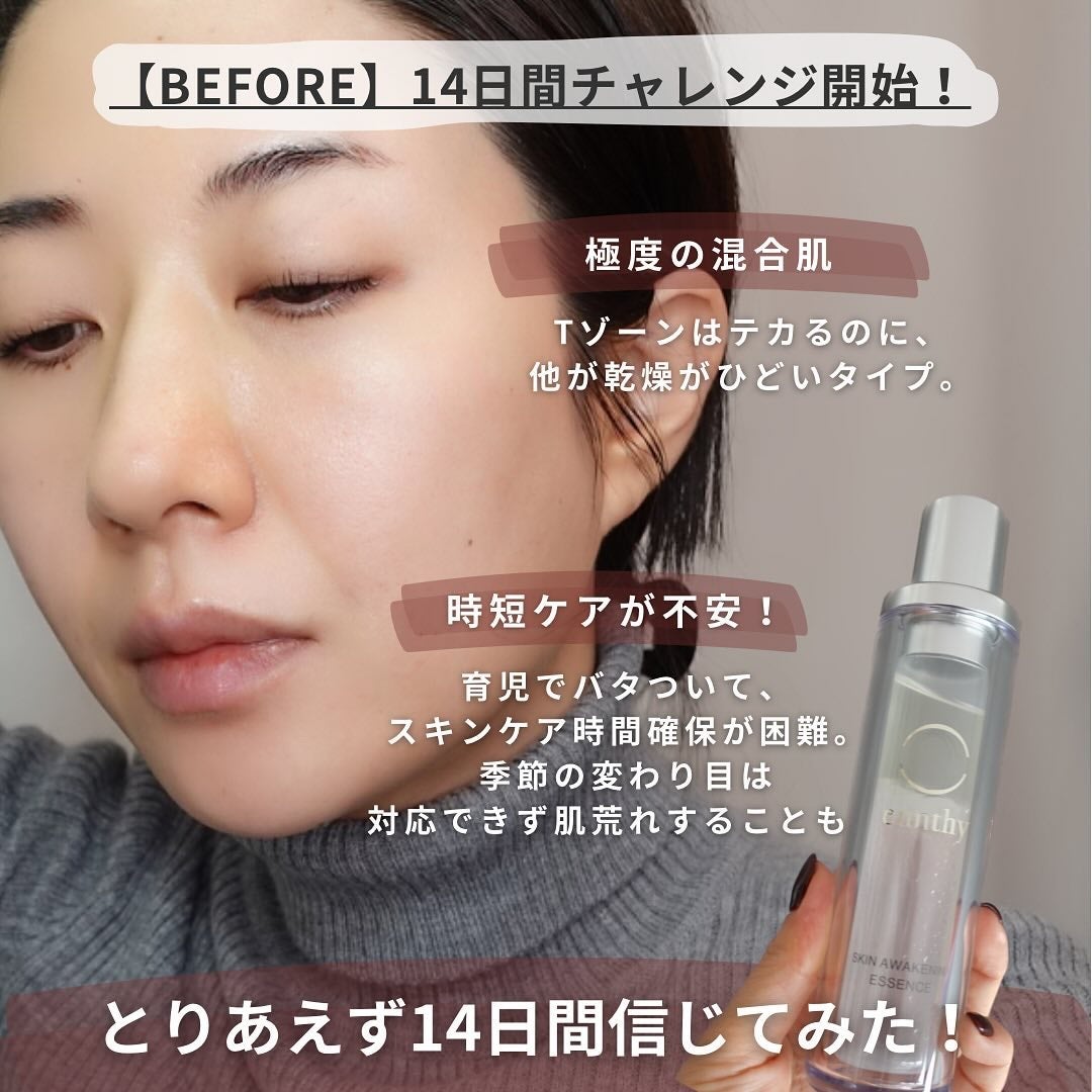 スキンアウェイクニングエッセンス/ennthy/美容液を使ったクチコミ(7枚目)
