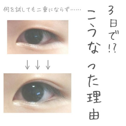 のび〜る アイテープ 両面テープタイプ/DAISO/二重まぶた用アイテムを使ったクチコミ(1枚目)