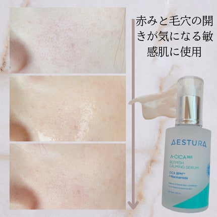 エイシカ365マイクロセラム/AESTURA/美容液を使ったクチコミ(3枚目)