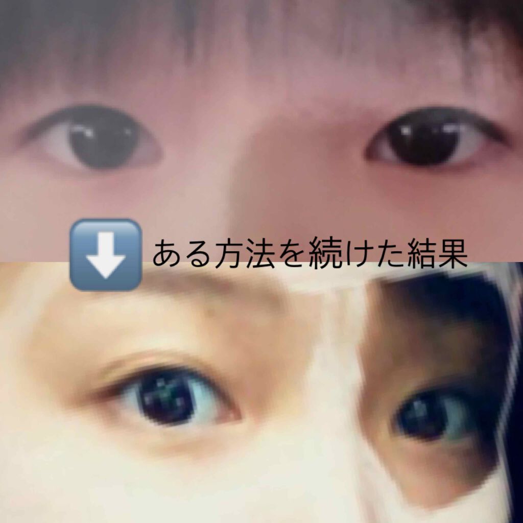 アイトーク/アイトーク/二重まぶた用アイテムを使ったクチコミ（1枚目）