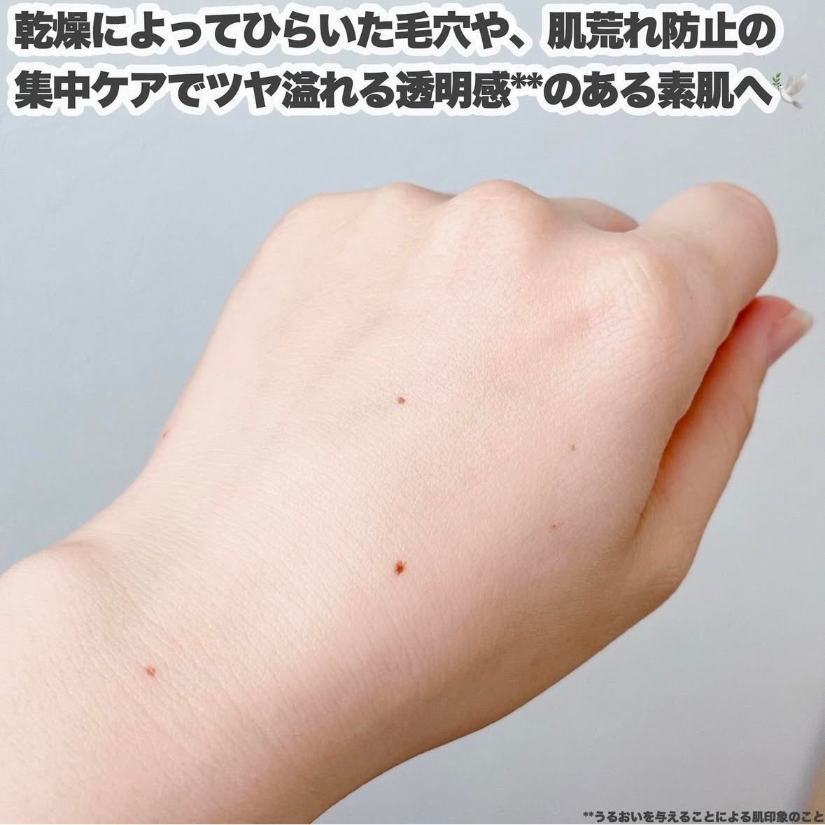 アゼペア 美容液/ネイチャーリパブリック/美容液を使ったクチコミ(5枚目)