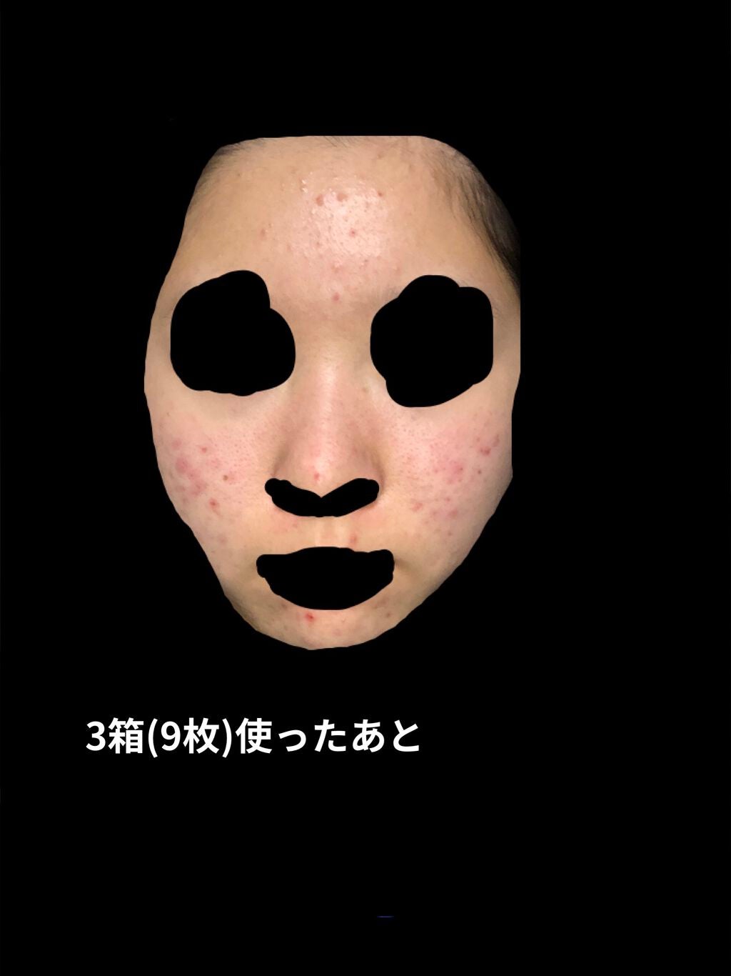 ティーツリーケアソリューション アンプルマスクJEX/MEDIHEAL/シートマスク・パックを使ったクチコミ(5枚目)