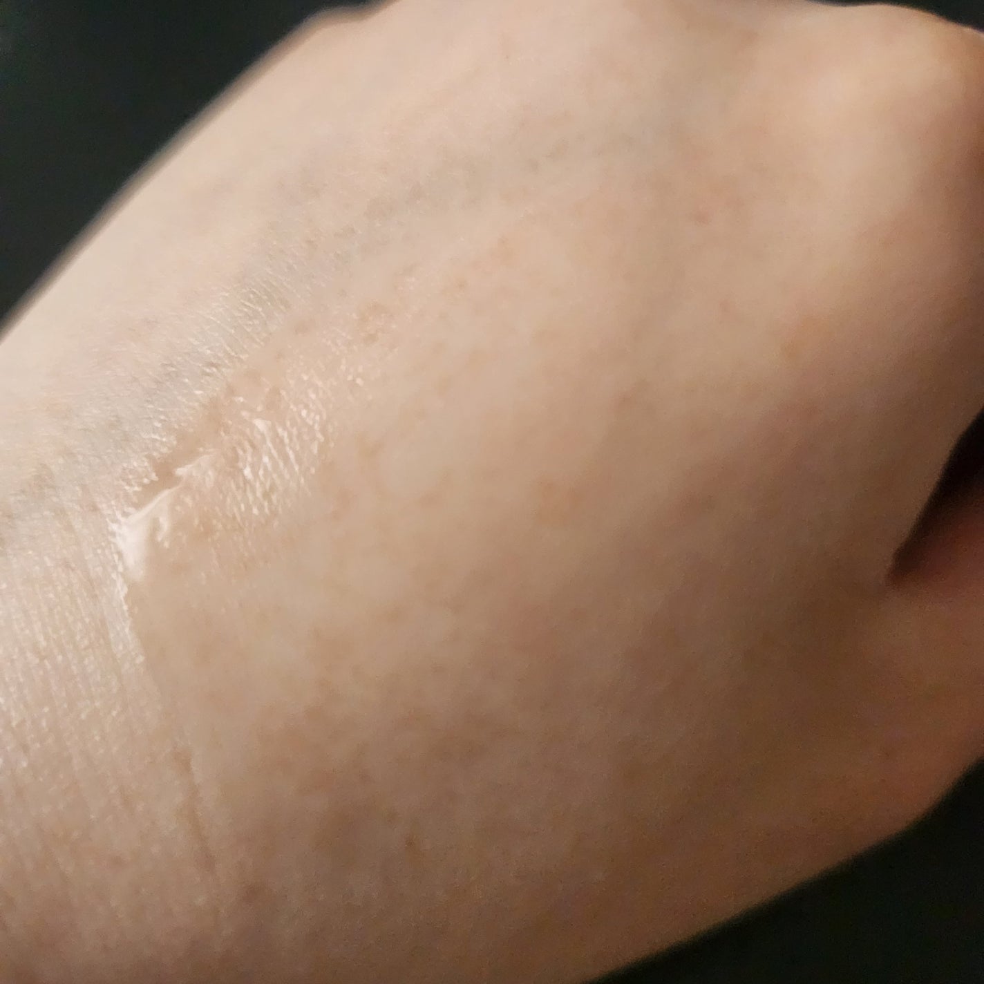 センテラ アンプル/SKIN1004/美容液を使ったクチコミ(3枚目)