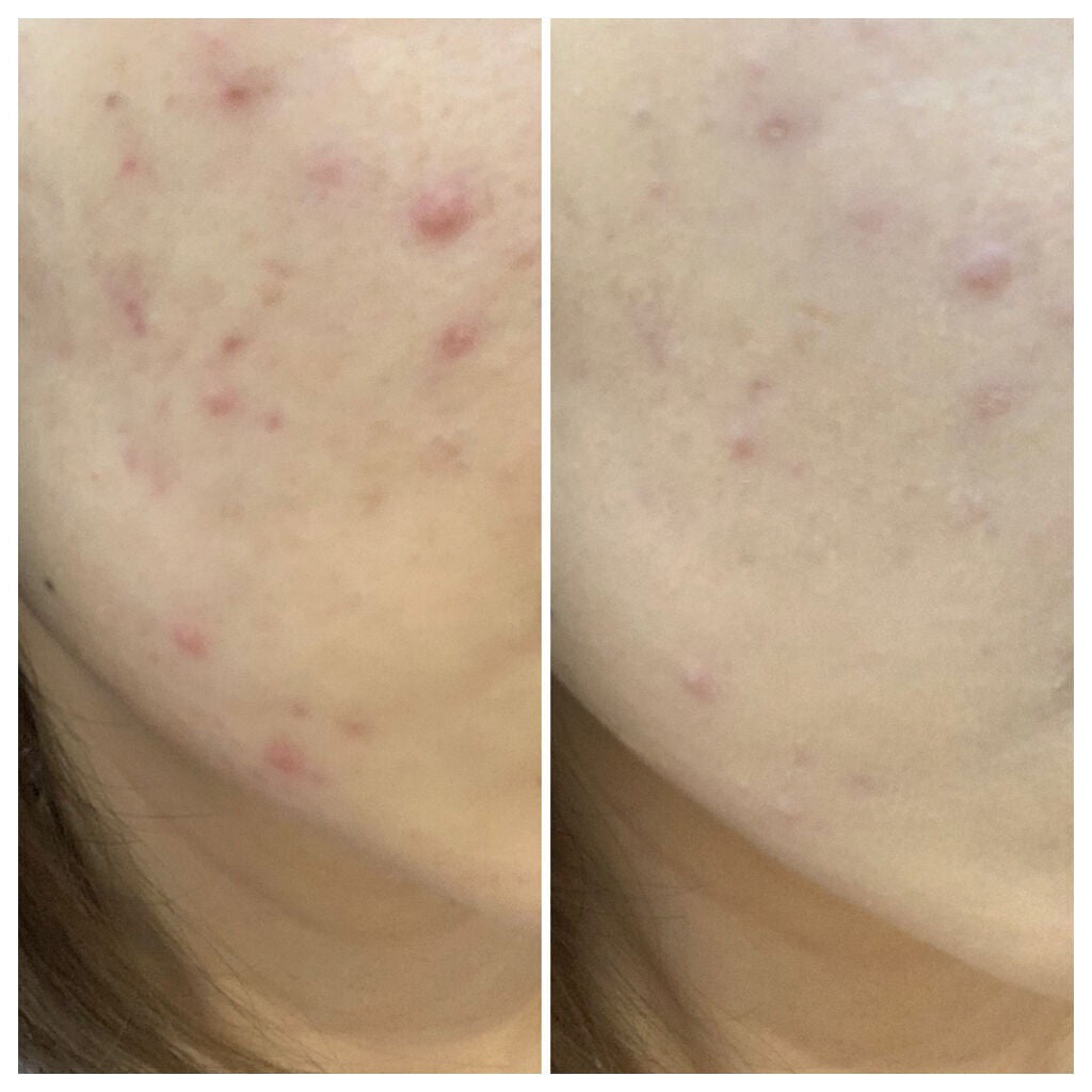 プレシャスキン パーフェクトフィニッシュ クッションファンデーション/DOLCE&GABBANA BEAUTY/クッションファンデーションを使ったクチコミ(5枚目)