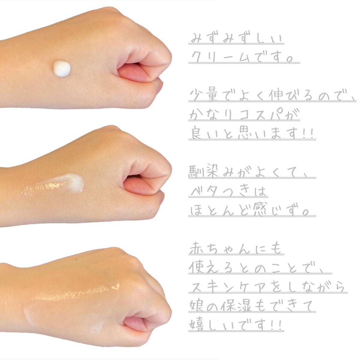 ヘパトリート 薬用保湿ミルククリーム/ゼトックスタイル/ボディクリームを使ったクチコミ(2枚目)