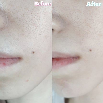 CICA ケアクリーム/BEAUSTA/フェイスクリームを使ったクチコミ(5枚目)