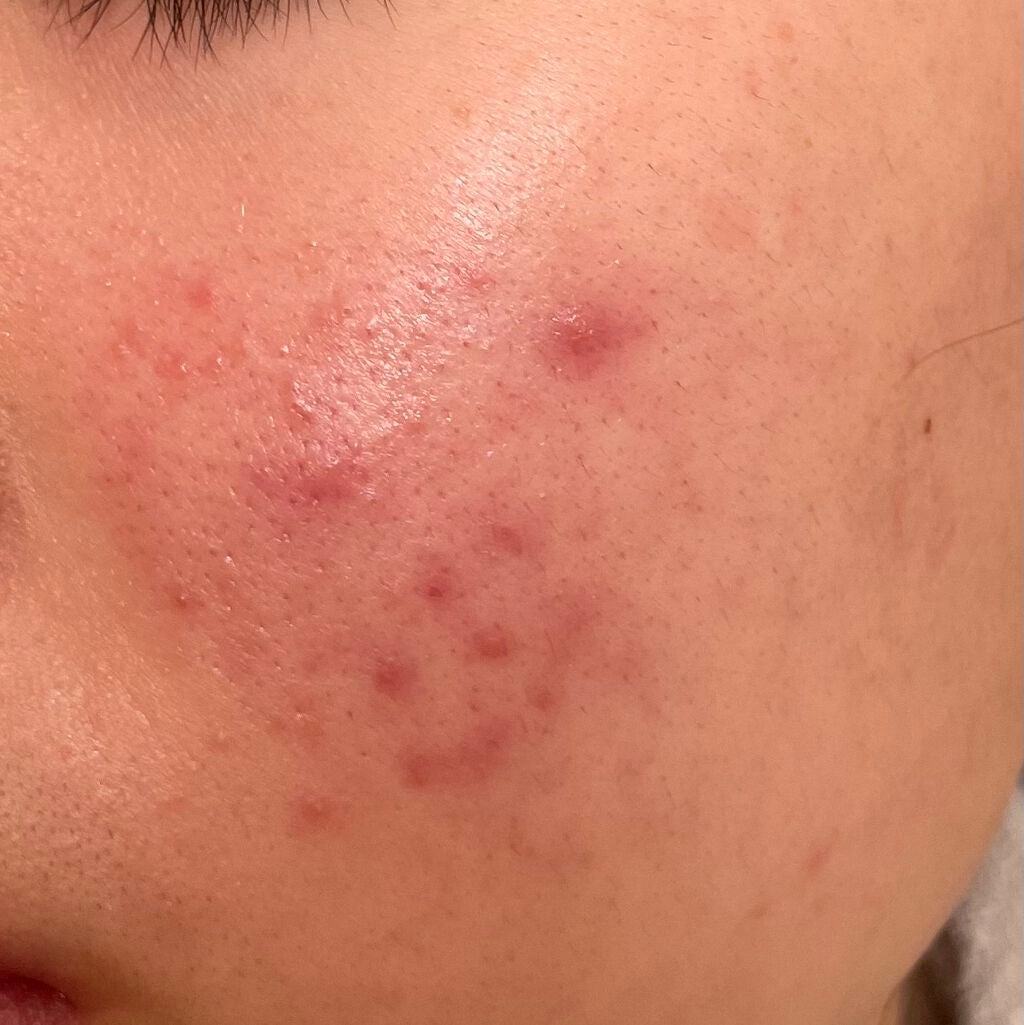 ハトムギ化粧水(ナチュリエ スキンコンディショナー R )/ナチュリエ/化粧水を使ったクチコミ(3枚目)