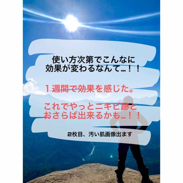 すみません、時間が無いのでざっと書きます！(；＿；)

バイオイルは少し前から使ってましたが、5滴ほどをちょびちょびとニキビ跡が気になるところに塗っても、全くと言っていいほど効果を感じませんでした。

