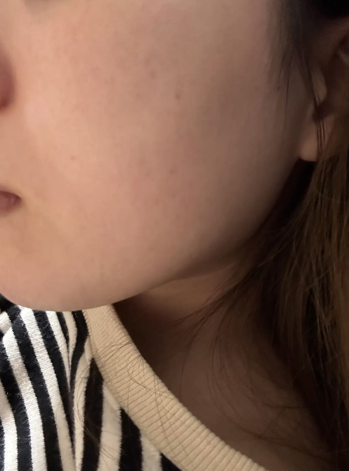 ホワイトニング ミスト セラム/アルージェ/ミスト状化粧水を使ったクチコミ（3枚目）