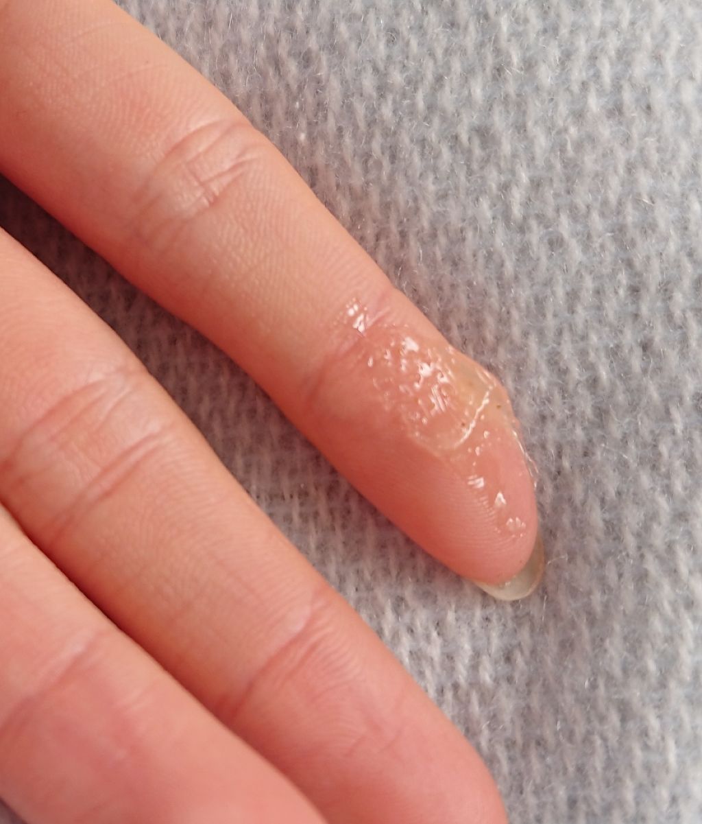 ワンダーハニー 唇とろ蜜ゴマージュ/VECUA Honey/リップケアを使ったクチコミ（2枚目）