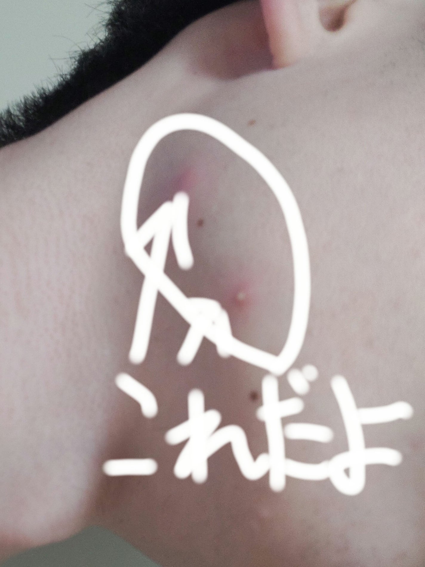 白潤 薬用美白化粧水/肌ラボ/化粧水を使ったクチコミ(5枚目)