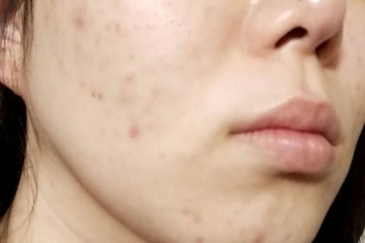  薬用リンクルホワイト ミルク/明色/乳液を使ったクチコミ（2枚目）