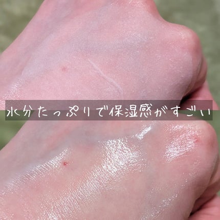 ヘルプミー! アイスクーリングパッド/One-day's you/トナーパッドを使ったクチコミ(6枚目)