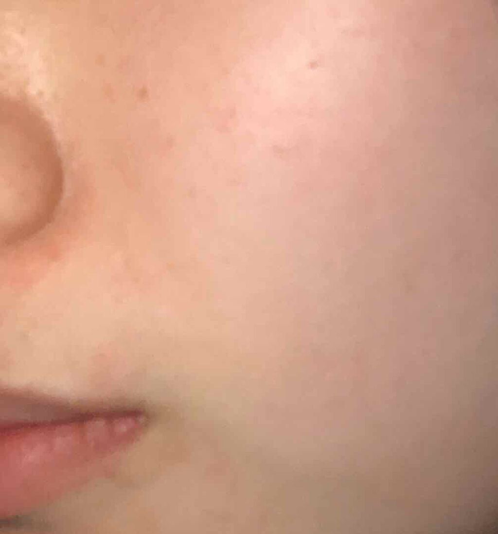 モイストリッチ クリアピーリングジェル/DHC/ピーリングを使ったクチコミ（2枚目）